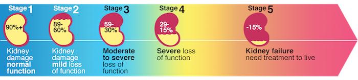 The 5 Stages Of Chronic Kidney Disease Milwaukee Nephrologists